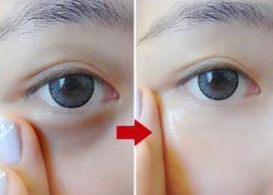 女眼霜抗皱去细纹什么品牌最好,眼霜推荐排行榜第一名去细纹眼袋