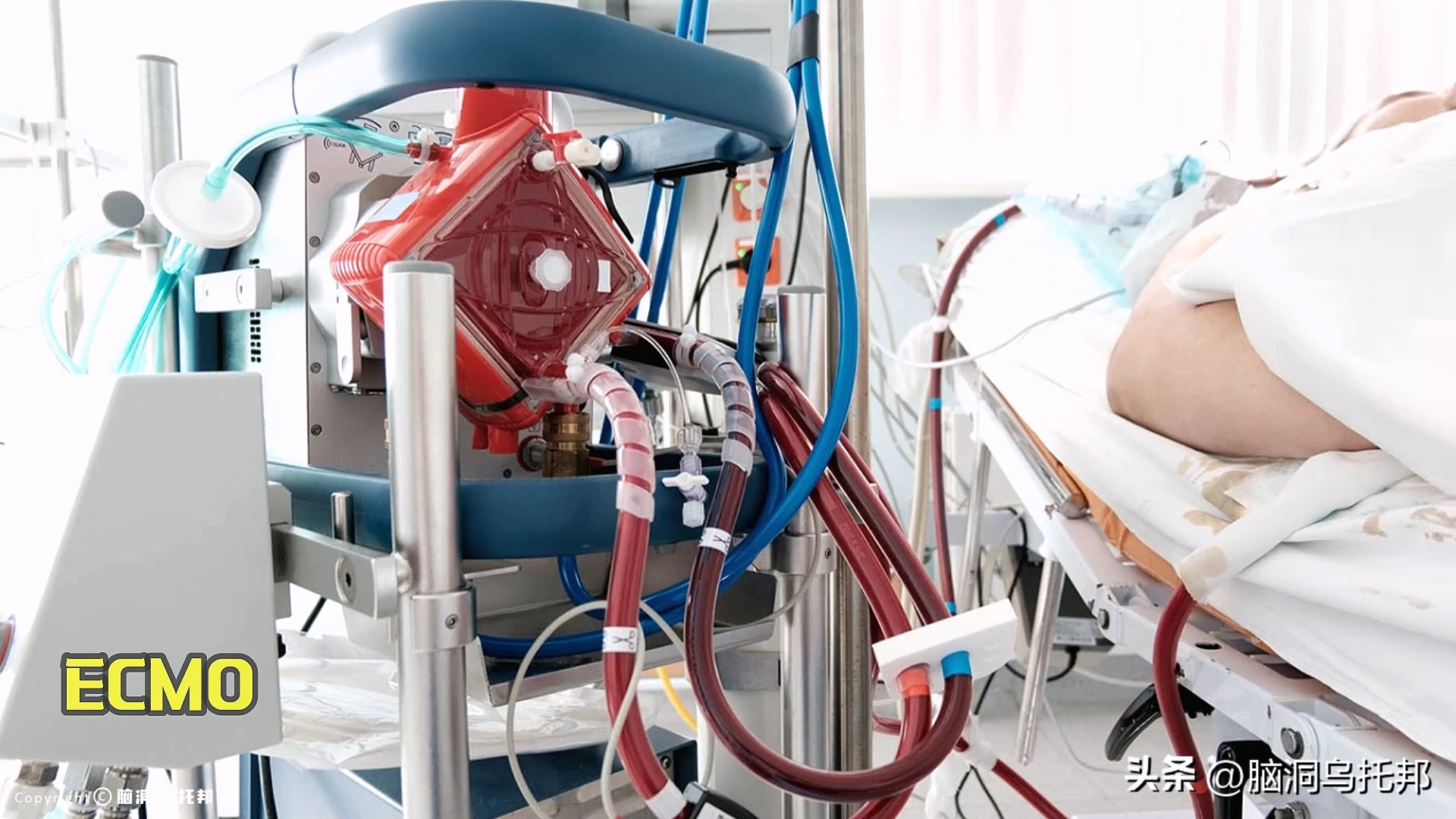 无症状感染是因为体质差吗,为什么有的人感染症状轻