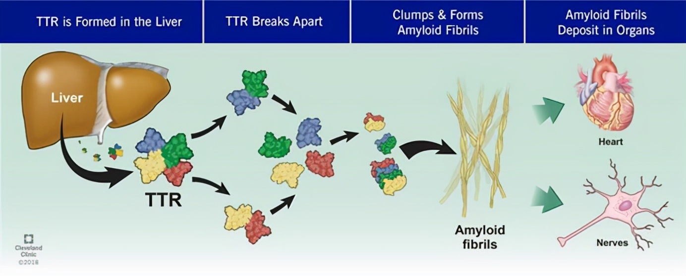 罕见病特效药孤儿药,罕见病药创新消息