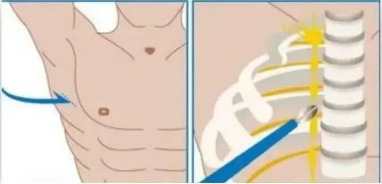 手心出汗是因为着急吗？不，手心总大量出汗是手汗症，要治疗