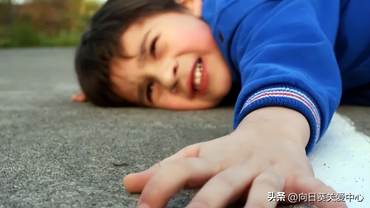 儿童癫痫患者的最佳治疗方法,儿童癫痫越早治疗越容易好吗