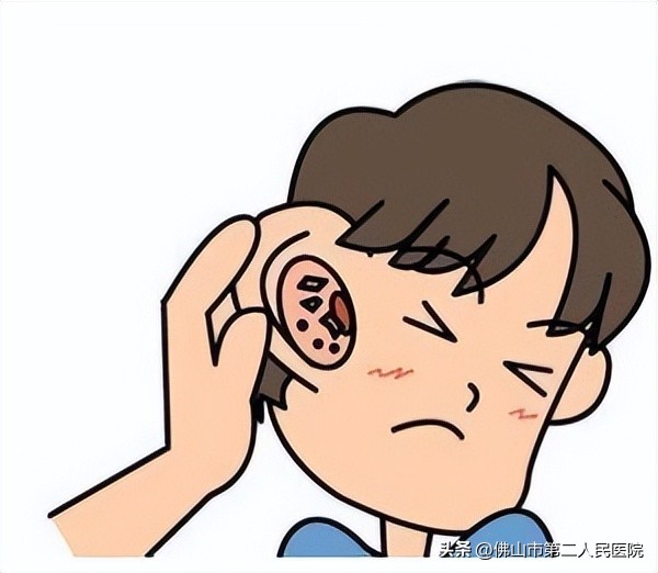 宝宝总是用手抠耳朵是有湿疹吗,宝宝耳朵长湿疹抓耳朵睡不好