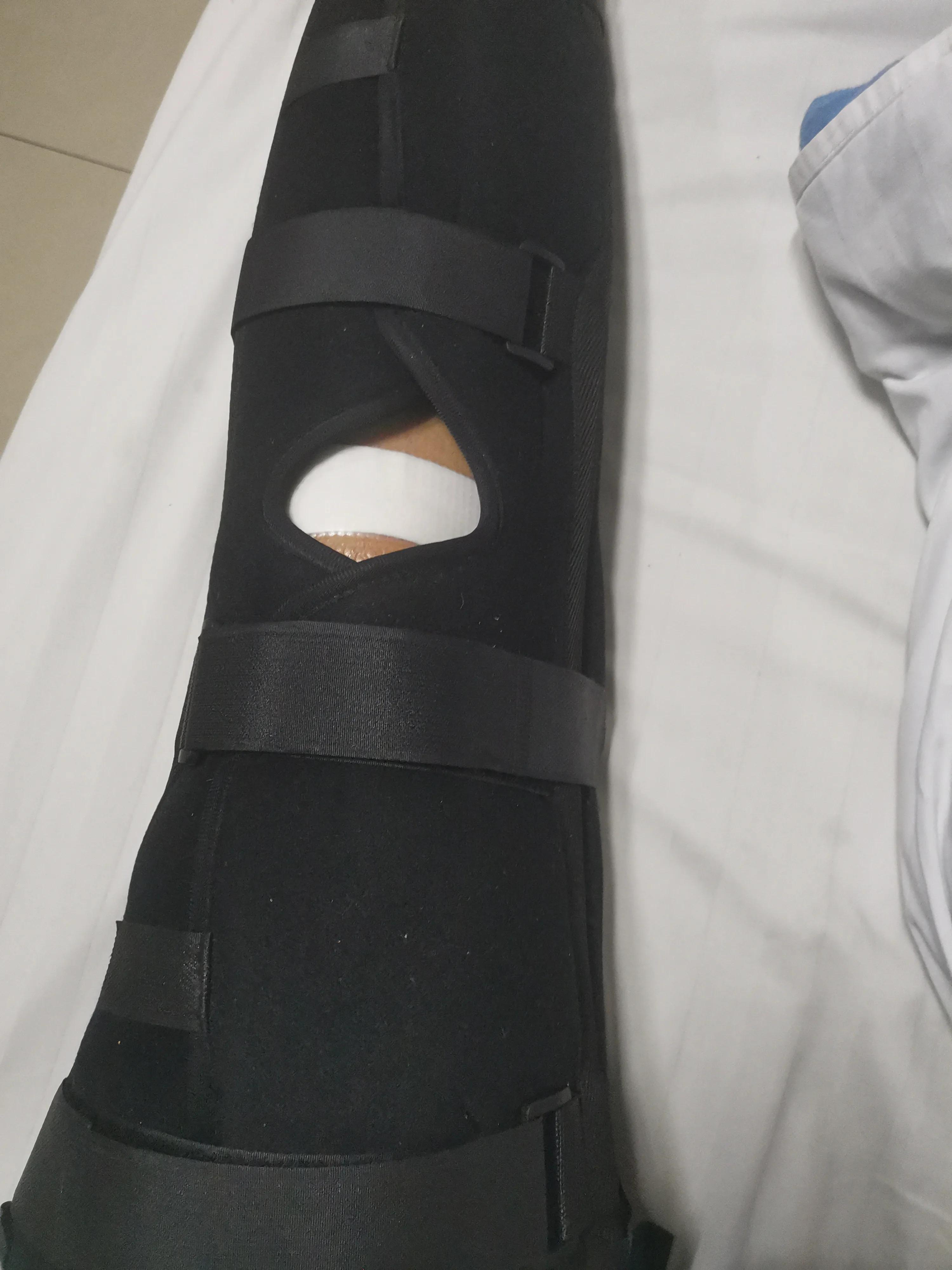 后角半月板撕裂微创手术,半月板撕裂微创手术沈阳