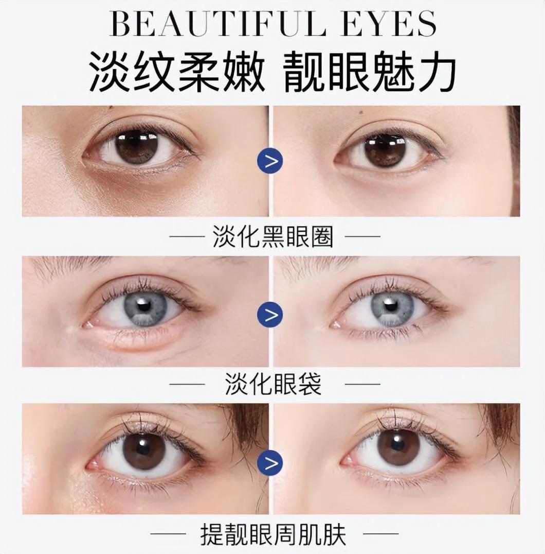 戚薇涂眼霜正确方法,戚薇涂眼霜的正确方法