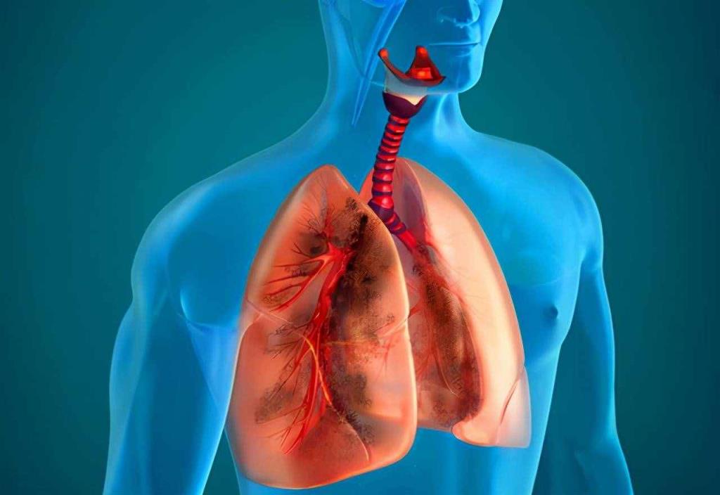 风热感冒中药银翘散,风热感冒的治疗方法藿香正气水