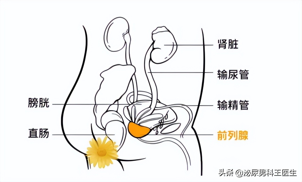 治疗前列腺增生最好的三种药,前列腺增生钙化吃什么药物有效