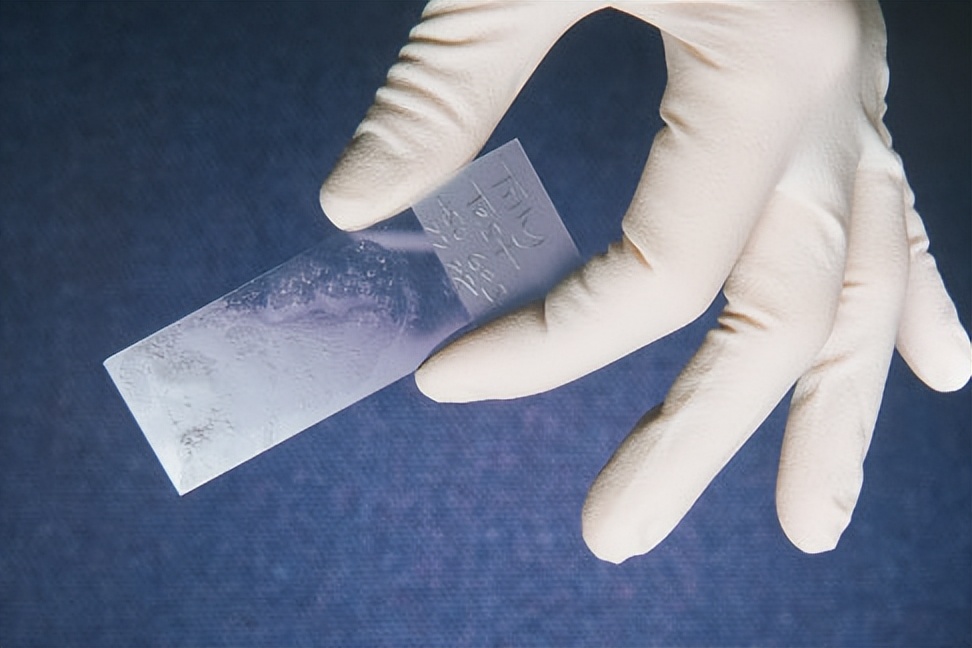 女性检查需要禁欲吗,已婚女性妇科必须做的体检