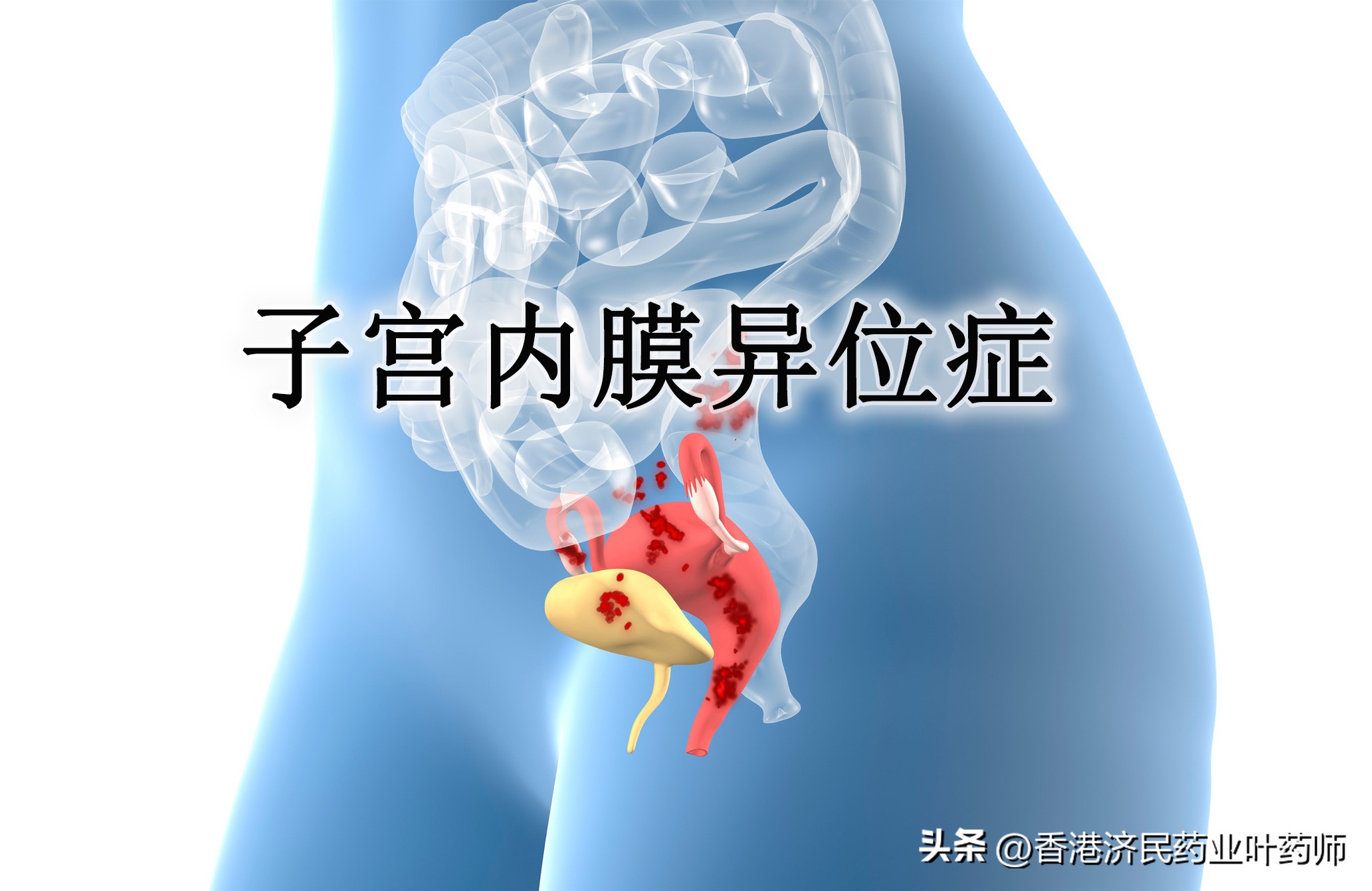 减少经期疼痛,减少姨妈疼痛