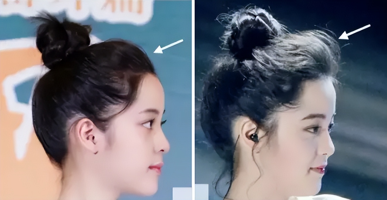 扁平脸影响美感,扁平头会对颜值有影响吗