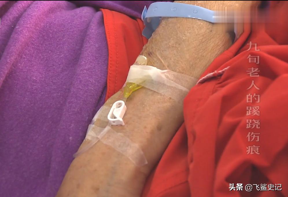 母亲被火灾烧伤,母亲被火烧死后续