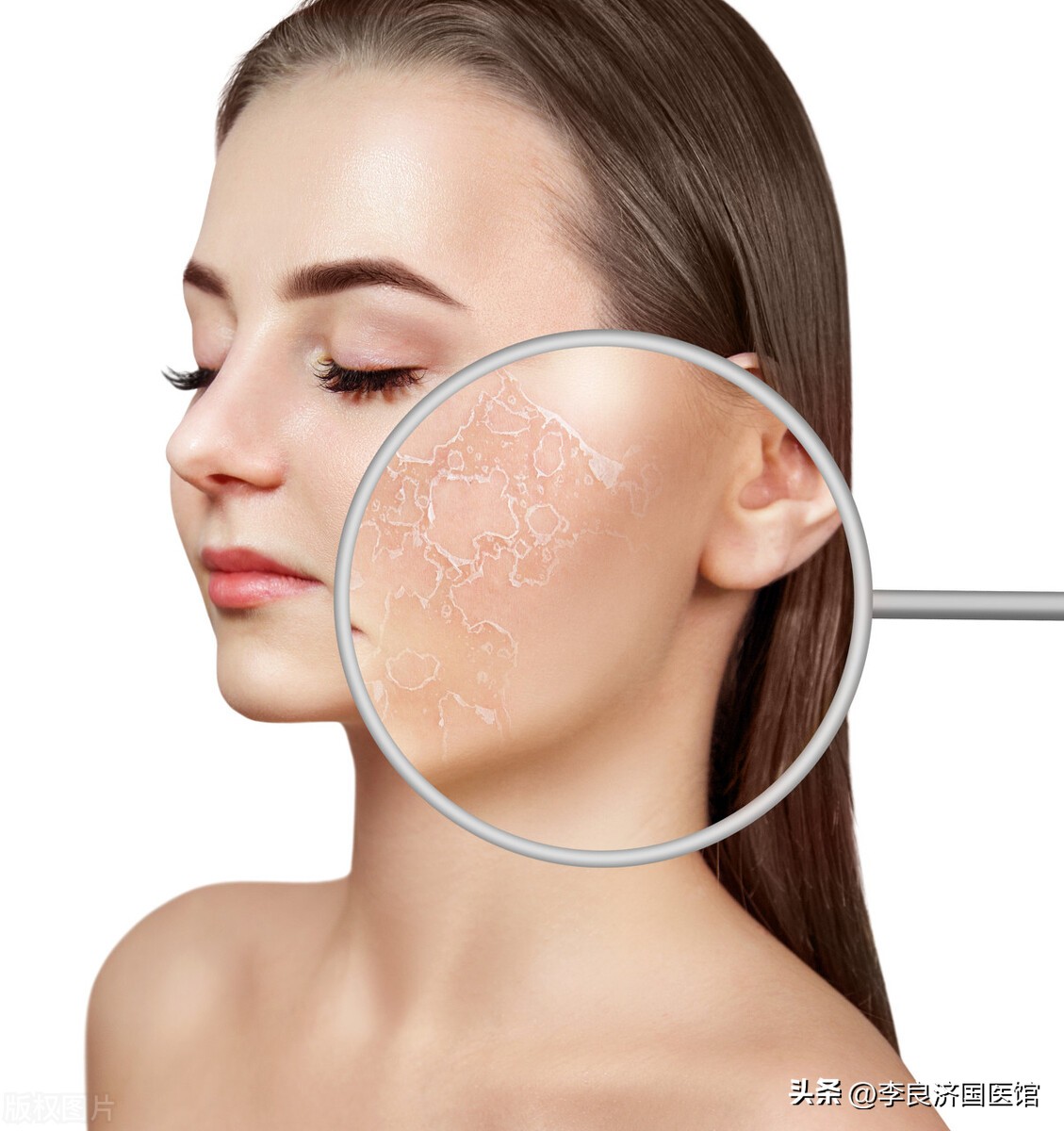 季皮肤瘙痒？掉皮屑？教您小妙招