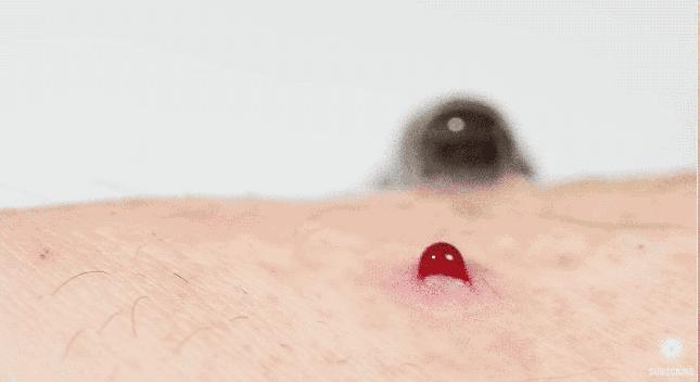 小宝宝出门怎么防护毒虫,带孩子出去玩当心这种虫子