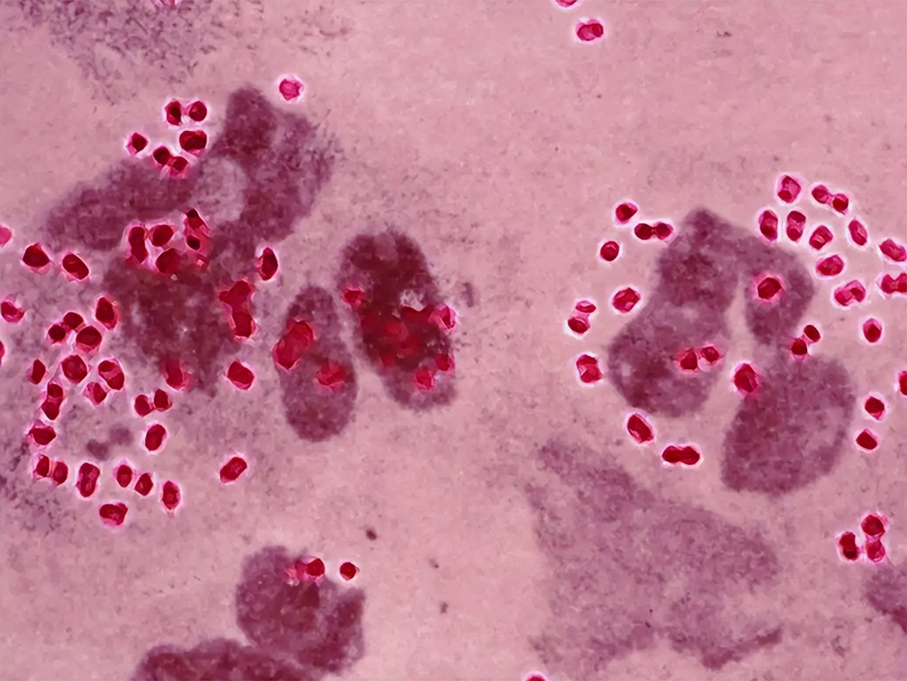 8种能通过“性传播”的病，你知道几个？建议大家多多了解学习