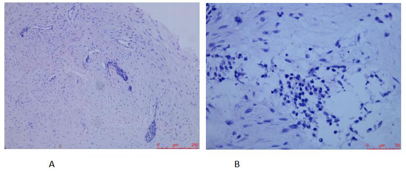 腹部鼓包是什么病,上腹部有包块伴有腹胀怎么回事