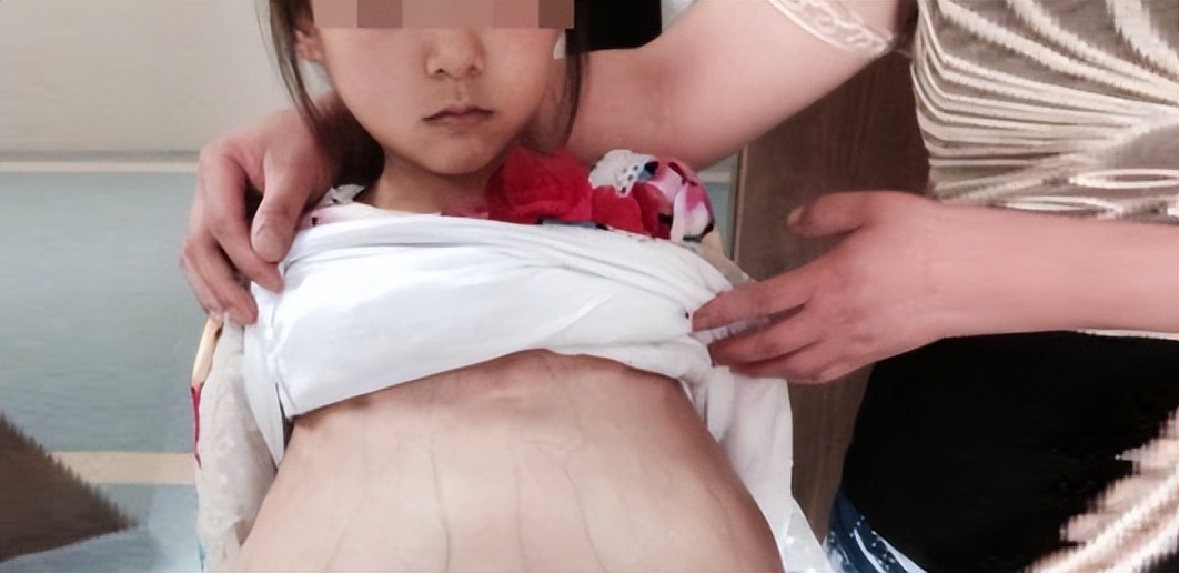 3岁女孩肚子疼医生报警,女童喊肚子疼