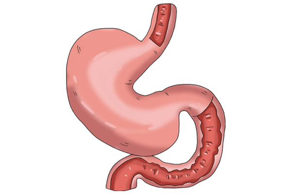 加州大学：喝“热茶”更利降血压！喝绿茶伤胃，喝红茶养胃，真假