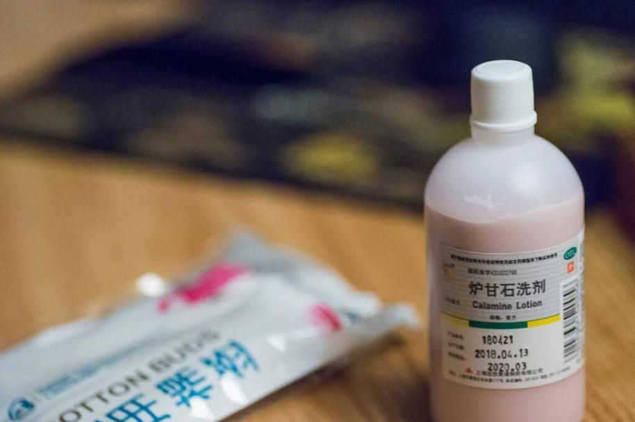 炉甘石洗剂功效多少钱一瓶,世卫组织推荐炉甘石