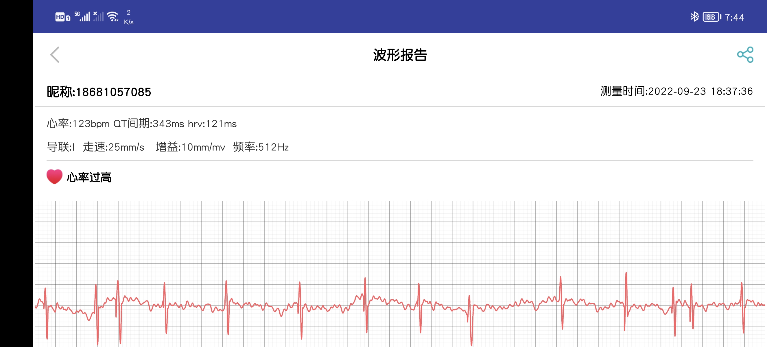 dido手表心率监测准不准,dido手表测血压评测