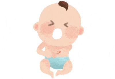 宝宝湿疹怎么保持皮肤干燥,新生儿湿疹皮肤怎样保湿