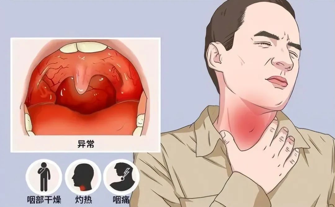 全网都在咽喉炎?除了新冠,还可能因为啥?(附缓解方法)