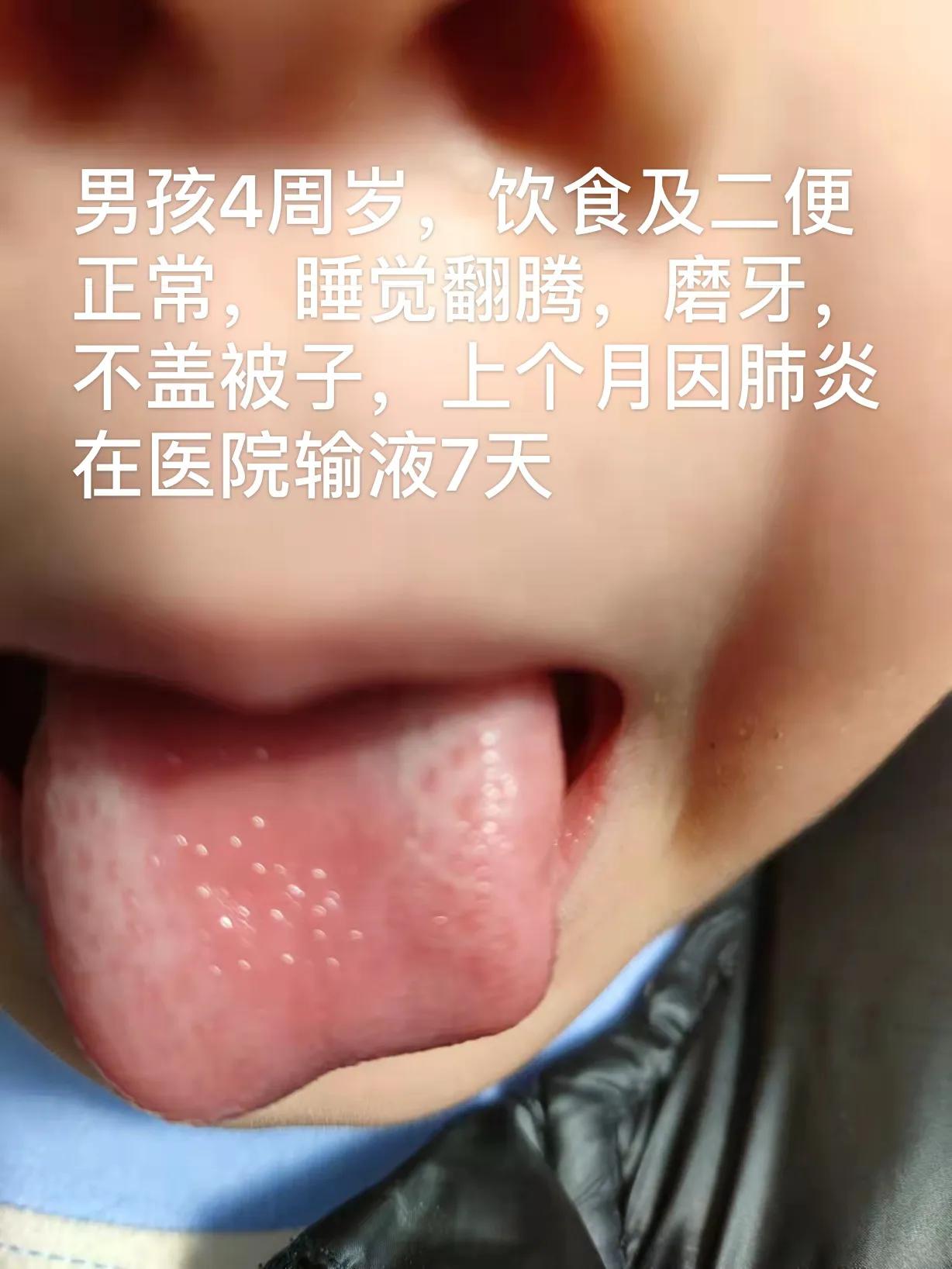 宝宝晚上睡个觉翻来覆去折腾，不睡觉，趴着，撅屁股睡，磨牙