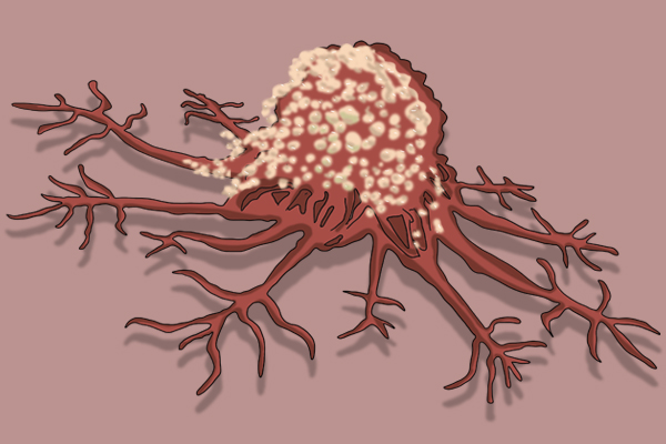 专家谈普洱茶危害,老普洱茶的细菌有多少