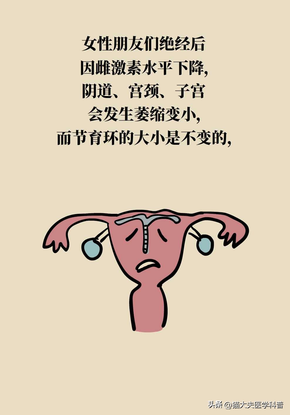 绝经后取环还会怀孕不,绝经后取环还能怀孕吗