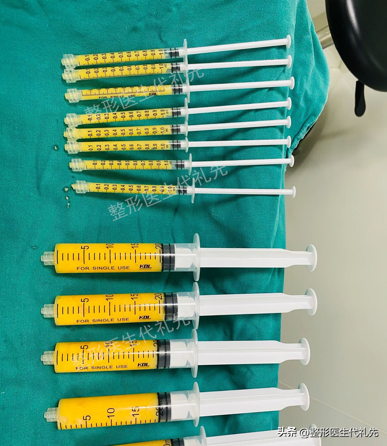 面部法令纹怎么去除,去除法令纹的日常方法