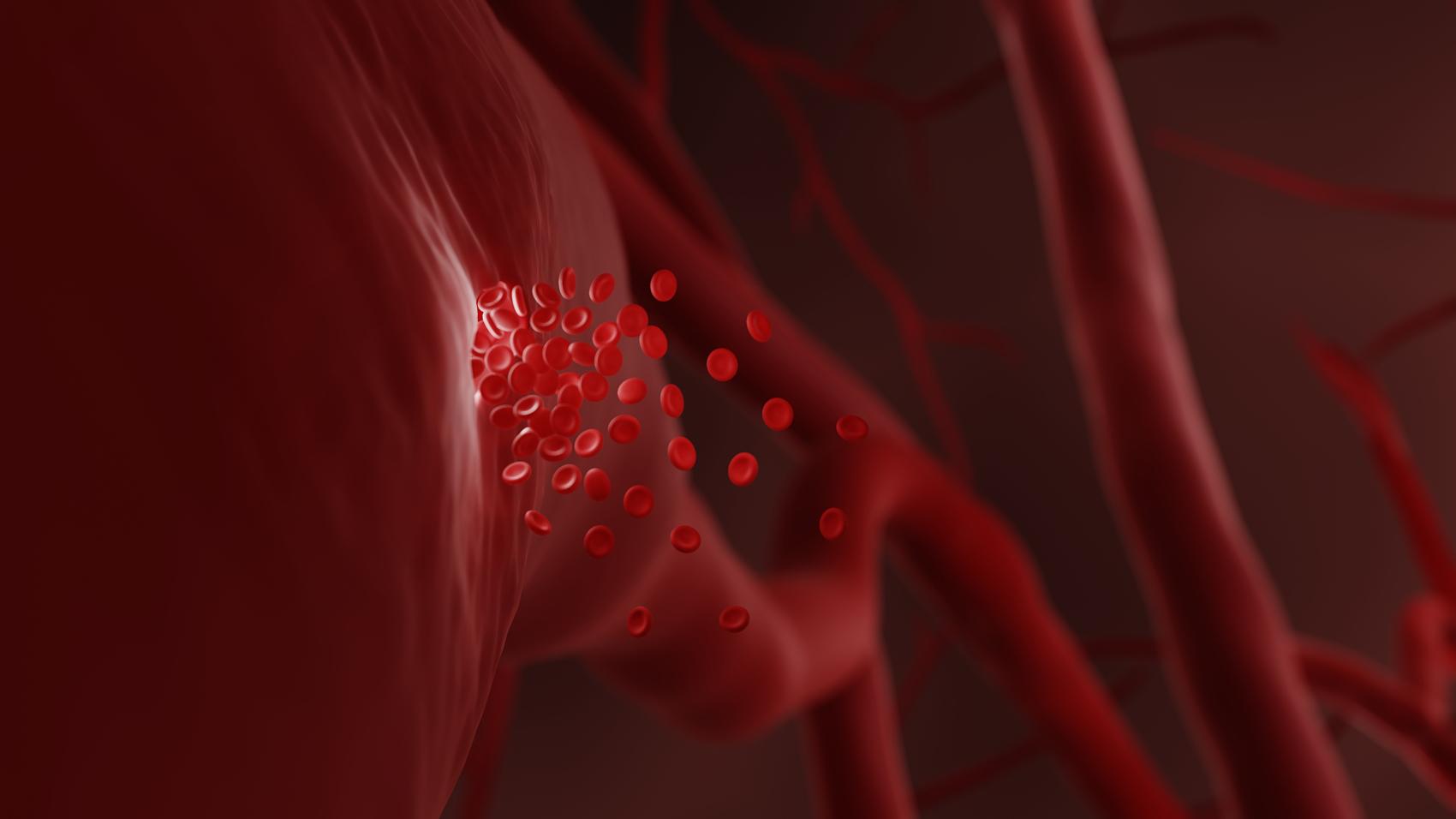 肝硬化怎么才能变软？