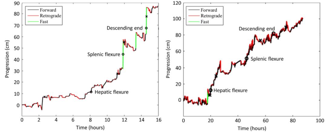 先别冲！原来你是这样的——“便便”