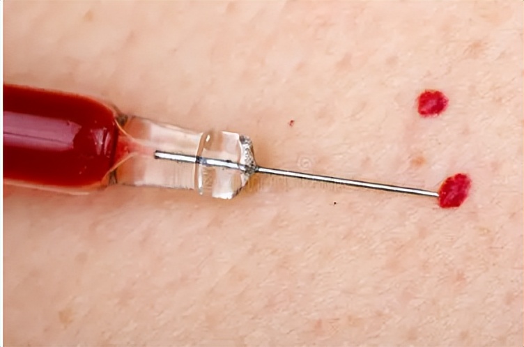 皮肤长了个凸起的小肉球怎么去除,皮肤长的小肉球怎么自己处理