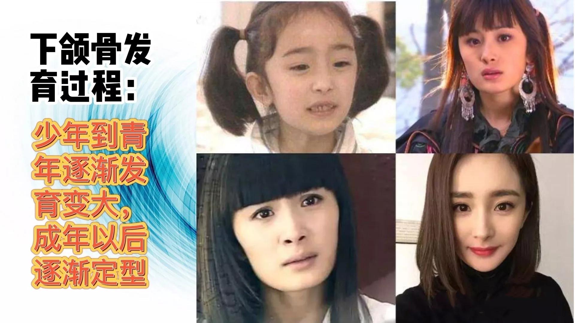 怎样防止脸越来越宽,怎么改善严重的大小脸