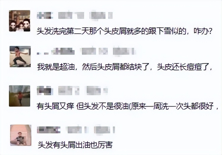 头皮发痒头屑多如何见效快,头皮发痒头屑多有什么好办法