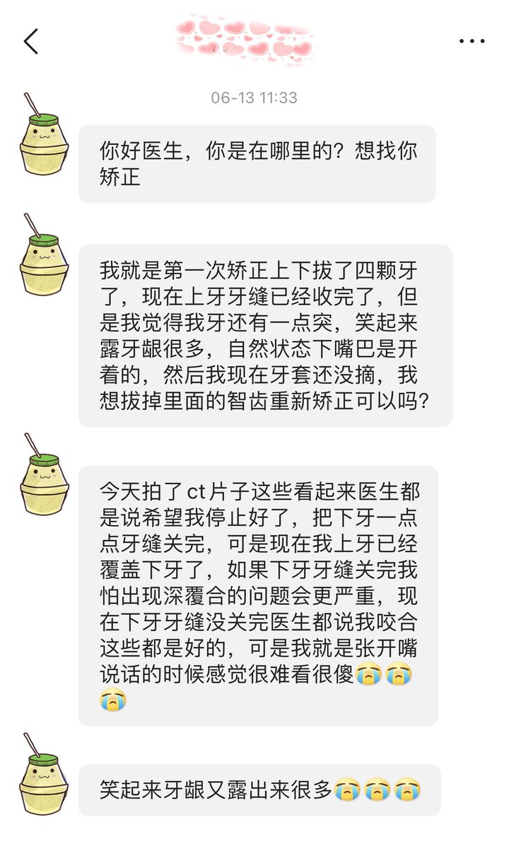 不拔牙矫正嘴凸下巴后缩案例,嘴瘪不拔牙矫正嘴会凸怎么办