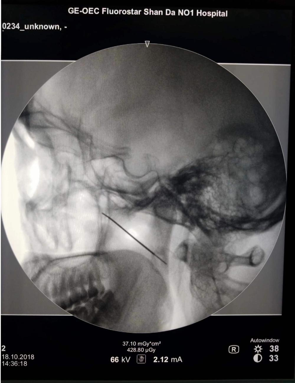 疼痛难忍最好的治疗方法,疼痛难忍的治疗