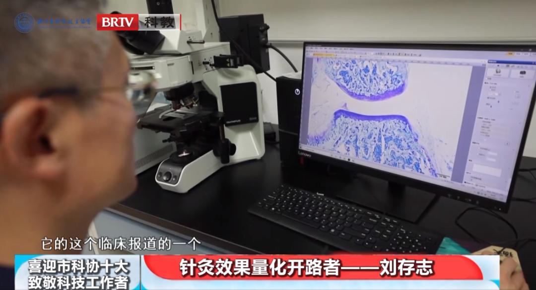中国针灸学会刘存志,刘存志针灸专家