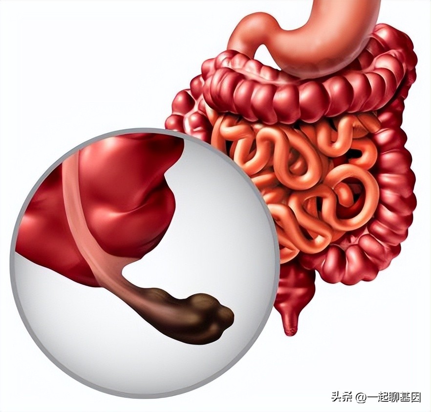 如何在公共场合防止放屁,如何在公众场合阻止放屁