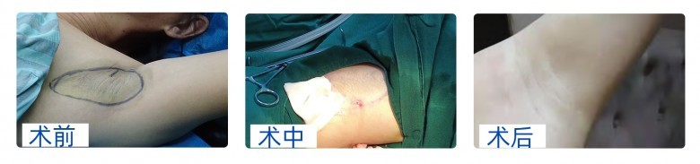 水刀黑科技视频,水刀超级黑科技