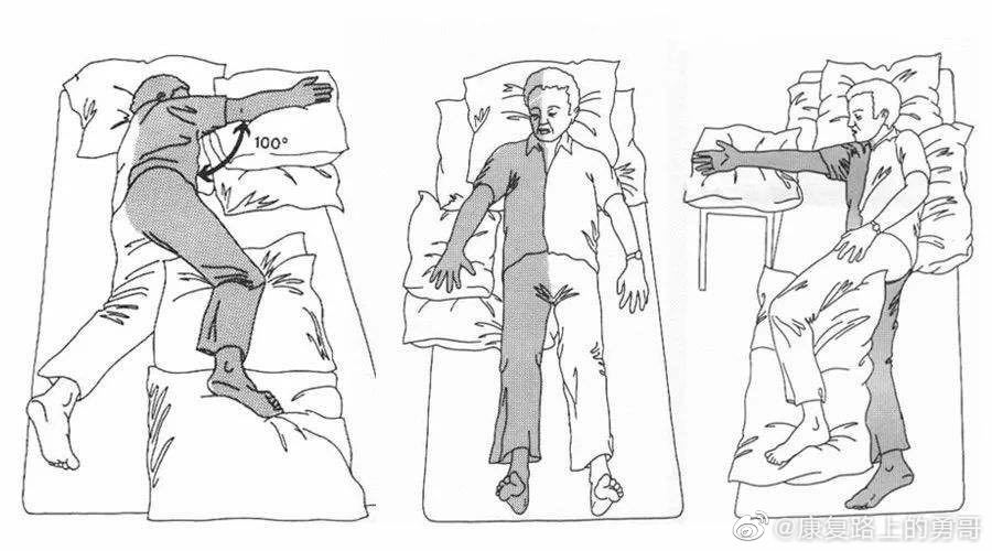 偏瘫患者肩部半脱位疼痛,偏瘫患者肩部力量怎样练