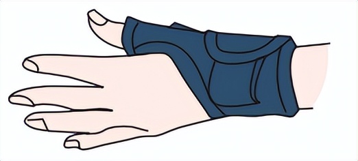 鼠标手、扳机指、键盘手、妈妈手……都是这个病