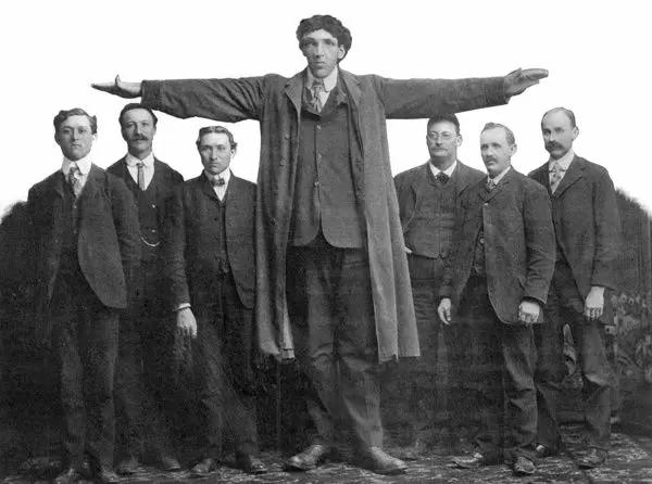 世界身高最高的10个人,盘点世界上最高的人3米61