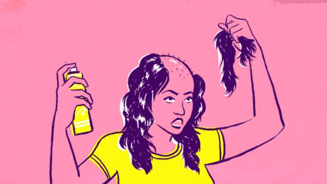 太“秃”然！如何守住“头”等大事