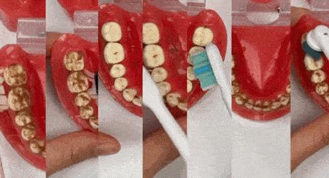 如何选择一款好的电动牙刷,如何选择一款好的电动牙刷呢