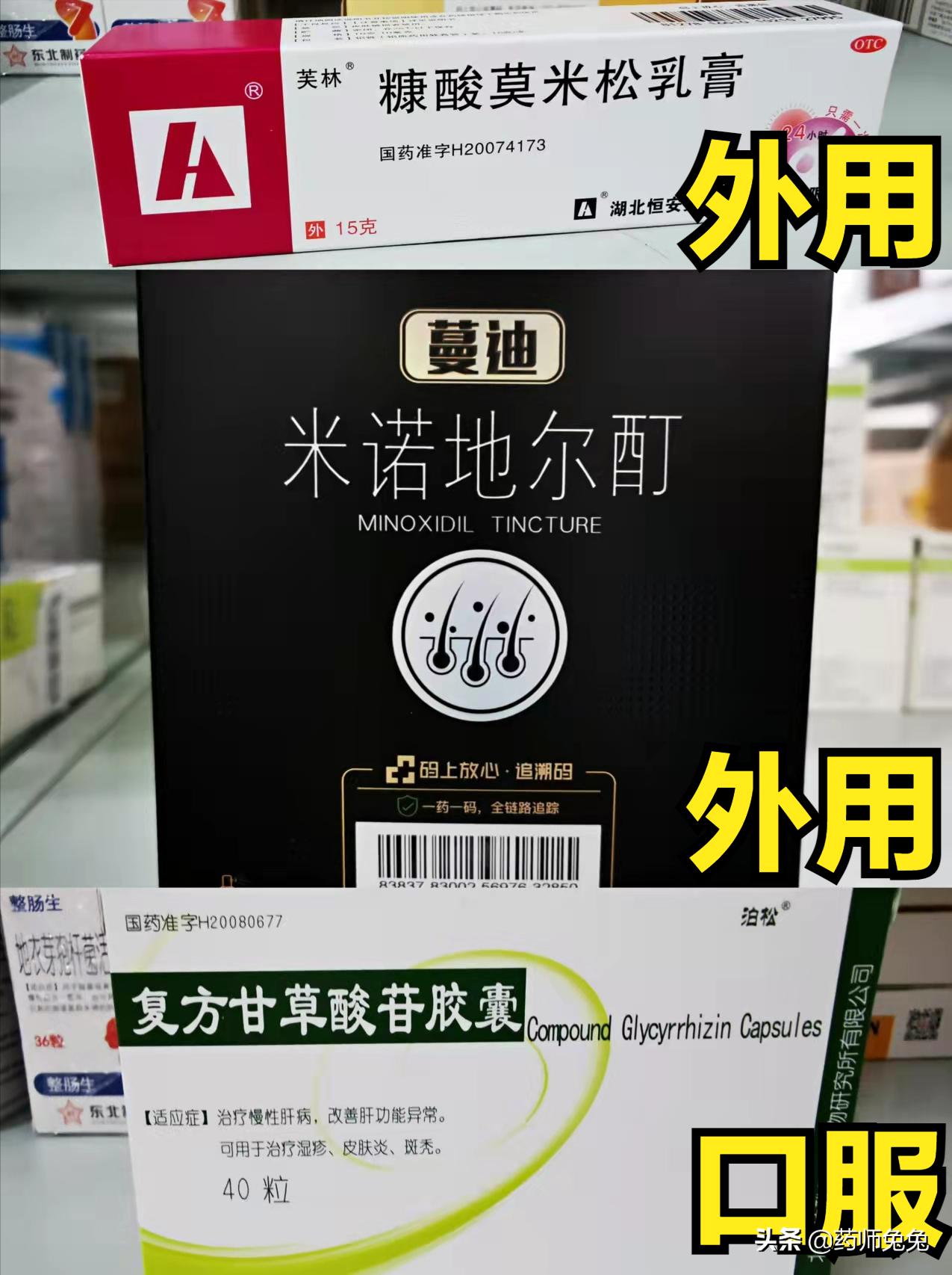 斑秃为什么叫鬼剃头啊,斑秃又被称作为鬼剃头