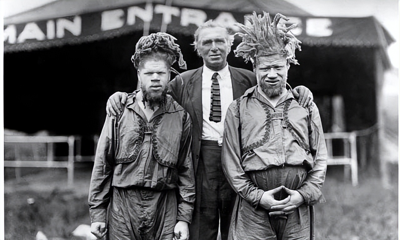 非洲最特殊的人群：血液堪比黄金，遗骸卖上百万，却无法健康成长