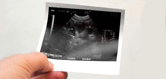 甲状腺结节专家张凯松简介,张凯松看甲状腺怎么样