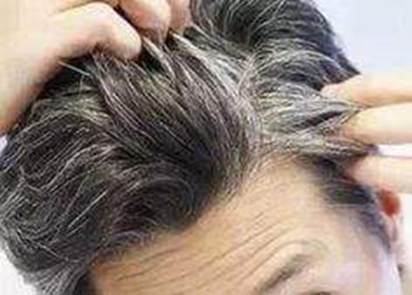 压力大会长白头发吗？这些习惯可能会催生白发