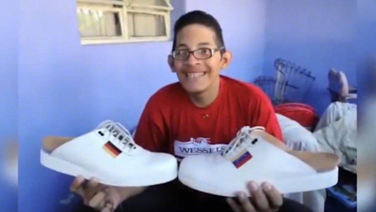 世界上身体部位最奇特的五个人,世界上身体最长的一个部位