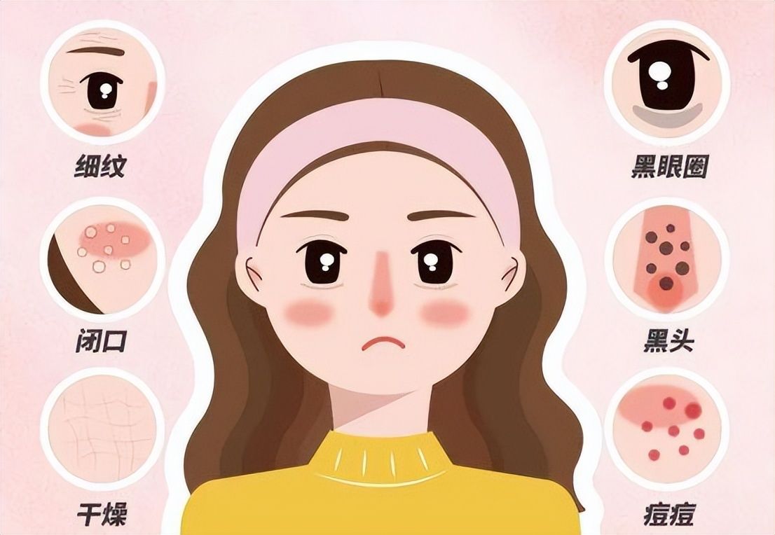 毛孔粗大黑头多脸爱出油小妙招,毛孔粗大黑头多脸爱出油用什么