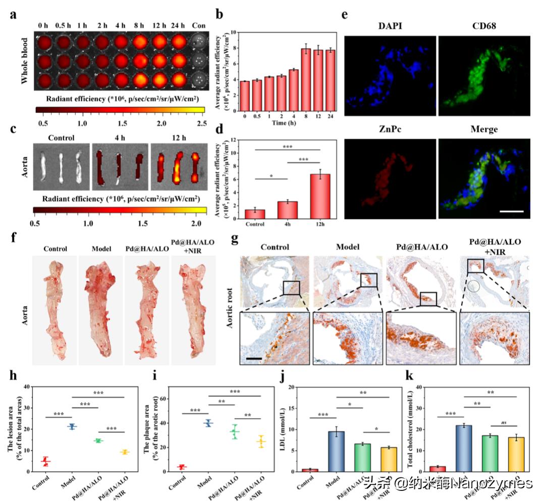 CCL|透明质酸修饰的负载苦豆碱的钯八面体用于治疗动脉粥样硬化